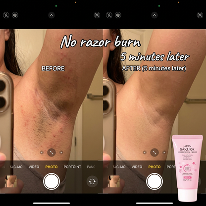 Lunece Japanese Hair Removal Cream
